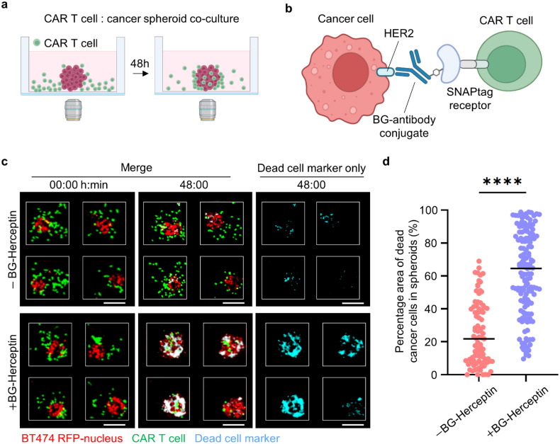 CAR T cell infiltration and cytotoxic killing within the core of 3D breast cancer spheroids under the control of antigen sensing in microwell arrays.