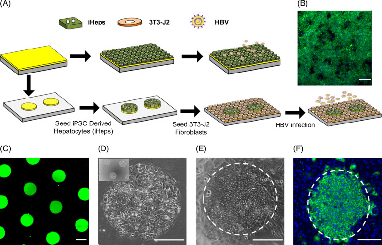 Long-term HBV infection of engineered cultures of induced pluripotent stem cell-derived hepatocytes.