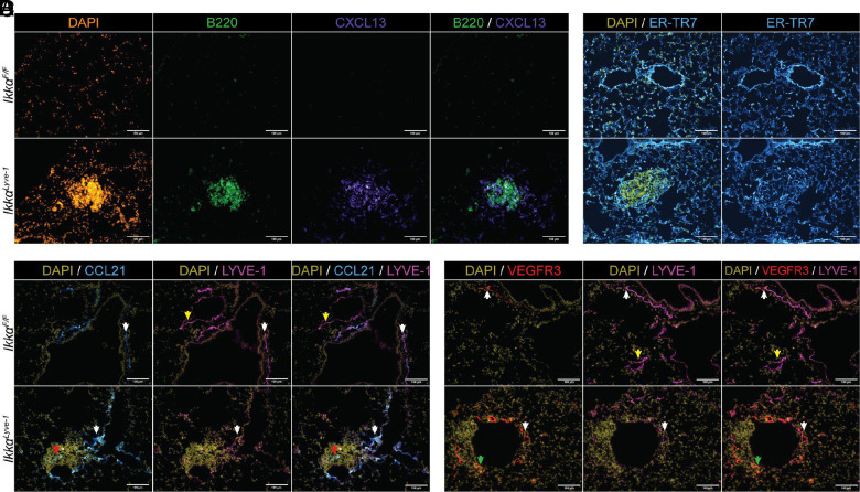 Loss of Lymphatic IKKα Disrupts Lung Immune Homeostasis, Drives BALT Formation, and Protects against Influenza.