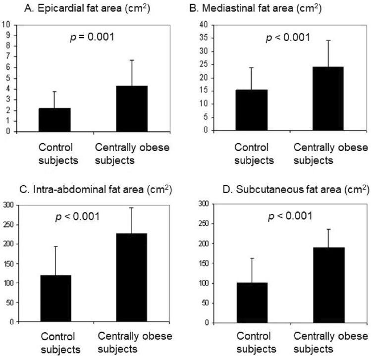 Central Obesity is Associated with Increased Left Ventricular Maximal Wall Thickness and Intrathoracic Adipose Tissue Measured with Cardiac Magnetic Resonance.