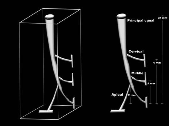 Filling ability of ready-to-use or powder-liquid calcium silicate-based sealers after ultrasonic agitation.