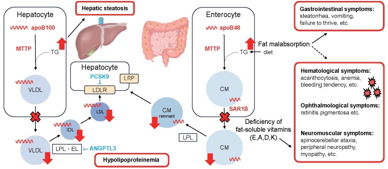 Current Diagnosis and Management of Familial Hypobetalipoproteinemia 1.