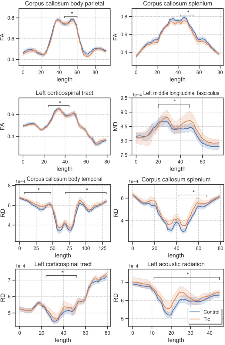Diffusion indices alteration in major white matter tracts of children with tic disorder using TRACULA.