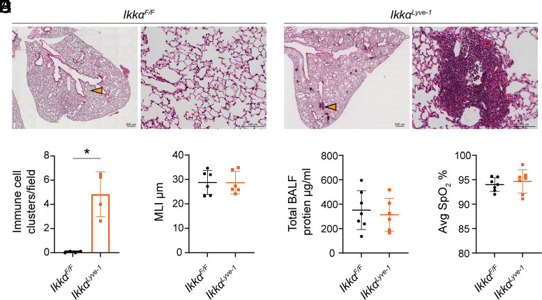 Loss of Lymphatic IKKα Disrupts Lung Immune Homeostasis, Drives BALT Formation, and Protects against Influenza.