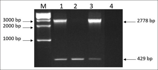 Molecular Background of RhD-positive and RhD-negative Phenotypes in a Saudi Population.