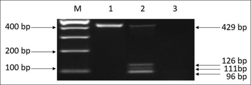 Molecular Background of RhD-positive and RhD-negative Phenotypes in a Saudi Population.