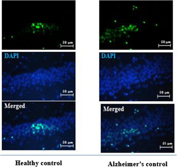 The interactive effects of different exercises and hawthorn consumption on the pain threshold of TMT-induced Alzheimer male rats.
