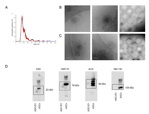 Adipose mesenchymal stem cells-derived extracellular vesicles exert their preferential action in damaged central sites of SOD1 mice rather than peripherally.
