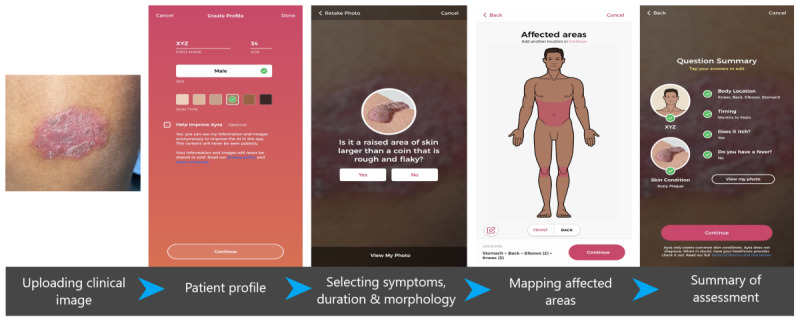 Efficacy of an Artificial Intelligence App (Aysa) in Dermatological Diagnosis: Cross-Sectional Analysis.