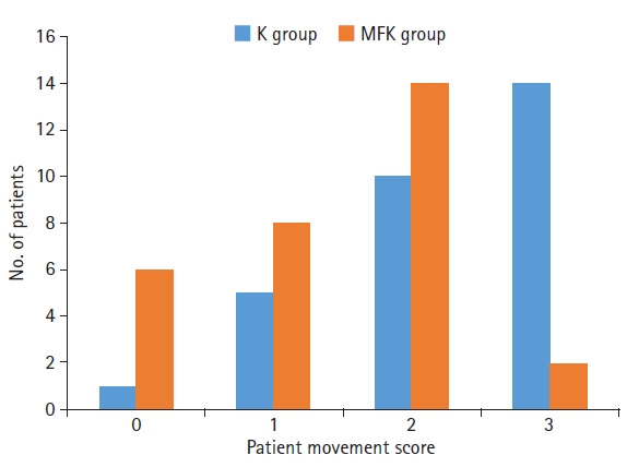 Enhancing ketamine anesthesia with midazolam and fentanyl for children's ear surgery: a prospective randomized study.