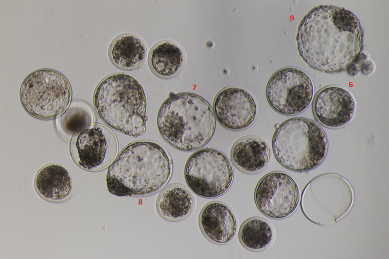 Analyzing Cell-free Genomic DNA in Spent Culture Media: Noninvasive Insight into the Blastocysts.