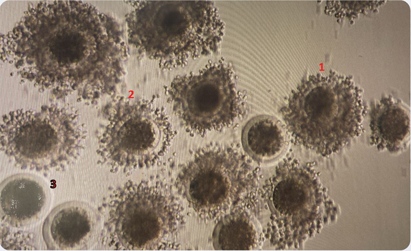 Analyzing Cell-free Genomic DNA in Spent Culture Media: Noninvasive Insight into the Blastocysts.