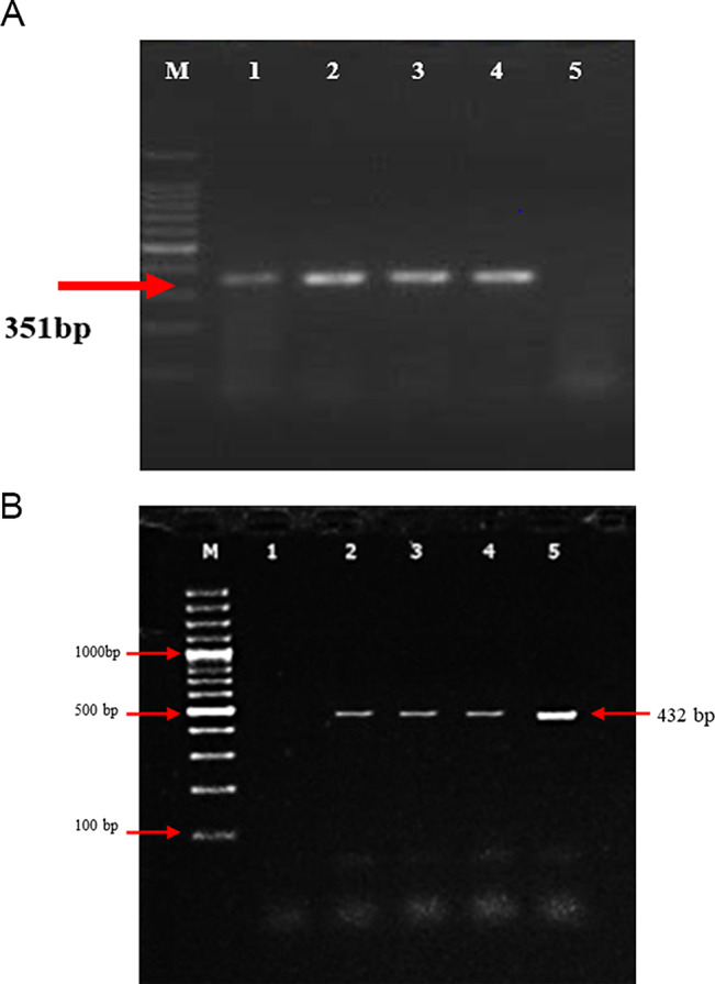 Molecular Characterization of Lineage-IV Peste Des Petits Ruminants Virus and the Development of In-House Indirect Enzyme-Linked Immunosorbent Assay (IELISA) for its Rapid Detection".