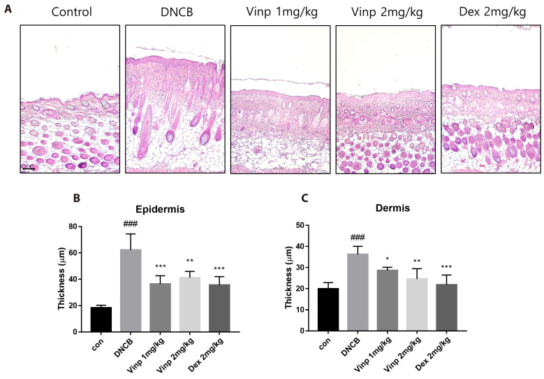 Vinpocetine, a phosphodiesterase 1 inhibitor, mitigates atopic dermatitis-like skin inflammation.