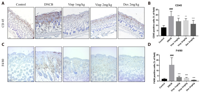 Vinpocetine, a phosphodiesterase 1 inhibitor, mitigates atopic dermatitis-like skin inflammation.