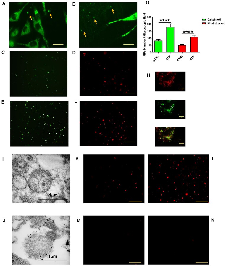 The P2X7 Receptor is a Master Regulator of Microparticle and Mitochondria Exchange in Mouse Microglia.