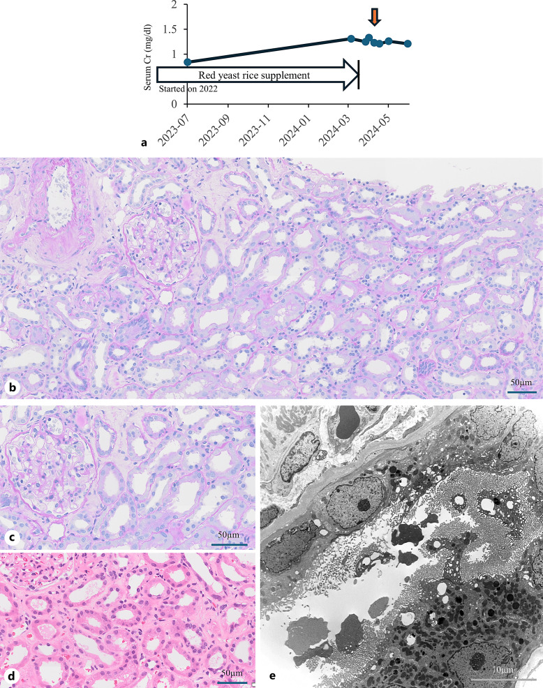 Renal Impairment of Proximal Tubular Injury Caused by Red Yeast Rice Supplement: Report of 2 Cases.