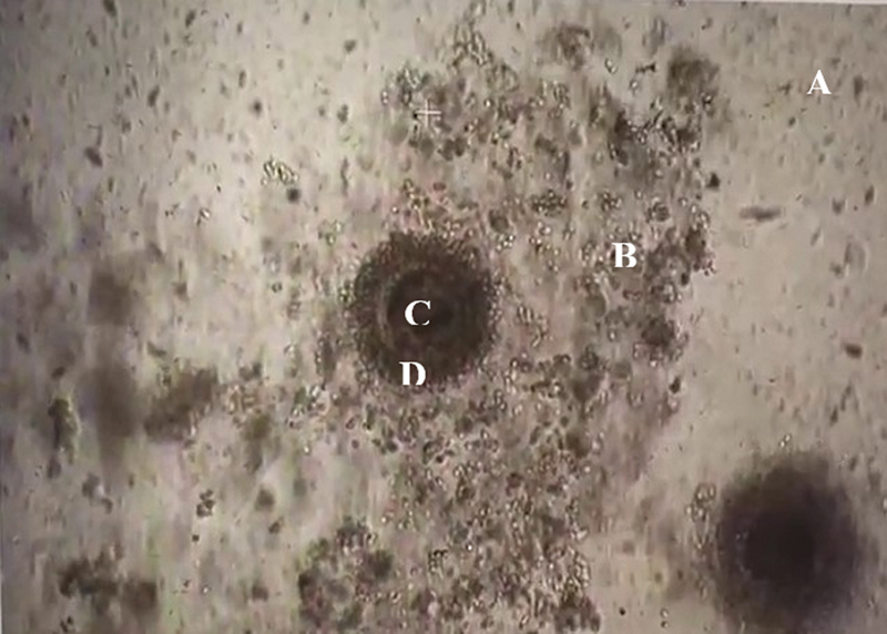 Analyzing Cell-free Genomic DNA in Spent Culture Media: Noninvasive Insight into the Blastocysts.