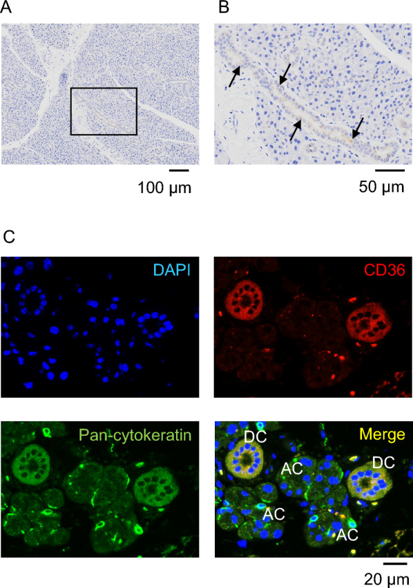 Age-related alteration of the involvement of CD36 for salivary secretion from the parotid gland in mice.