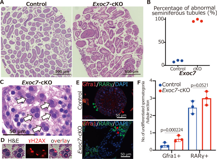 Deletion of Exoc7, but not Exoc3, in male germ cells causes severe spermatogenesis failure with spermatocyte aggregation in mice.