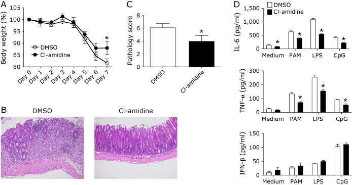 Reciprocal regulation of protein arginine deiminase 2 and 4 expression in the colonic mucosa of ulcerative colitis.
