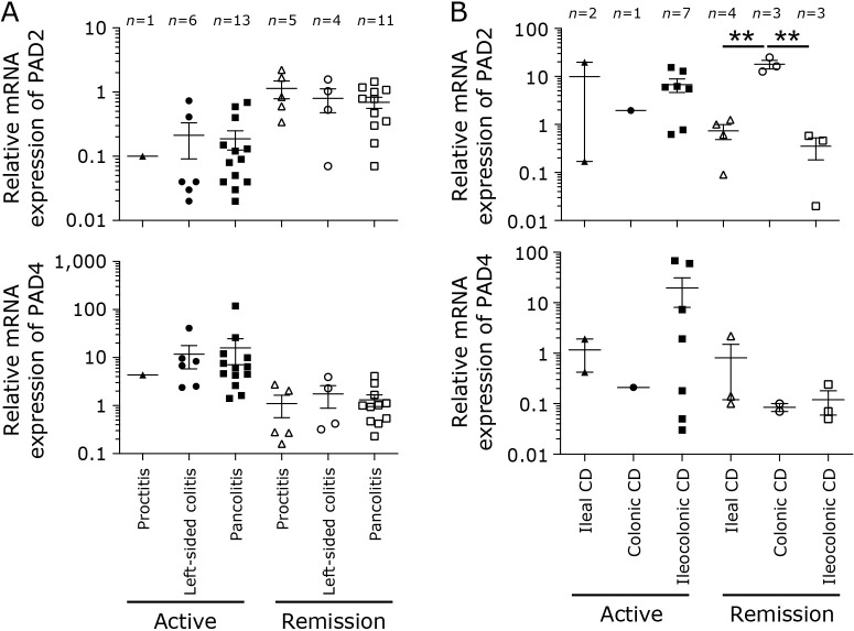Reciprocal regulation of protein arginine deiminase 2 and 4 expression in the colonic mucosa of ulcerative colitis.