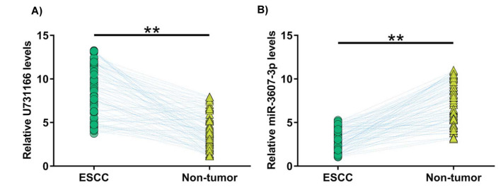 LncRNA U731166 Increases the Accumulation of TGFBR1 by Sponging miR-3607-3p in Esophageal Squamous-Cell Carcinomas (ESCC) to Promote Tumor Metastasis.