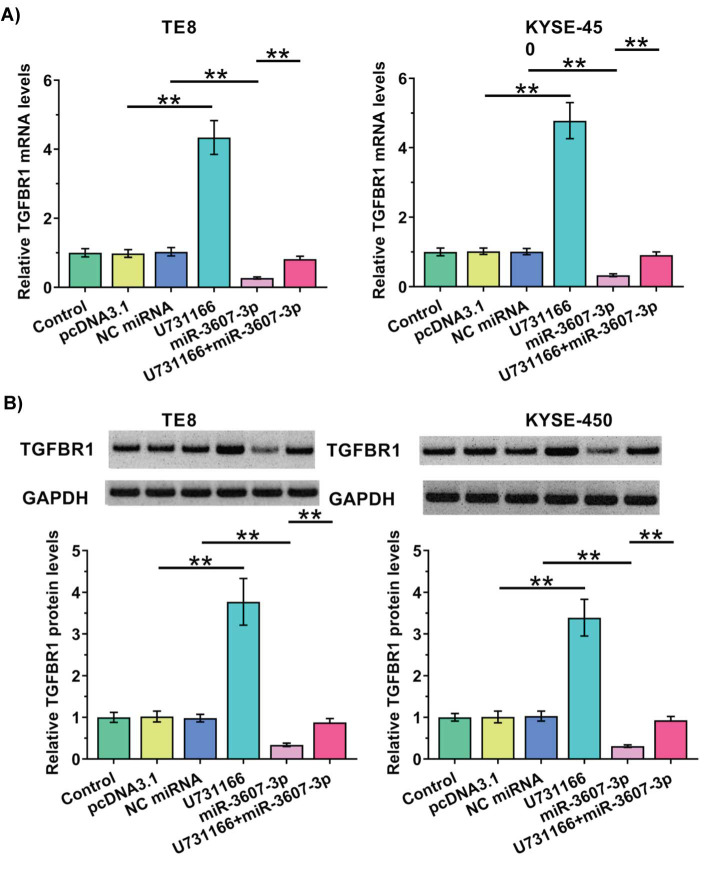 LncRNA U731166 Increases the Accumulation of TGFBR1 by Sponging miR-3607-3p in Esophageal Squamous-Cell Carcinomas (ESCC) to Promote Tumor Metastasis.