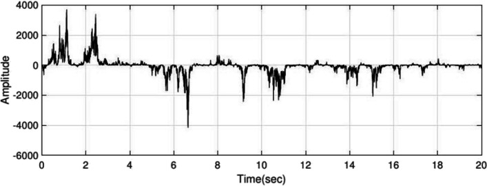 Short-term epileptic seizures prediction based on cepstrum analysis and signal morphology.