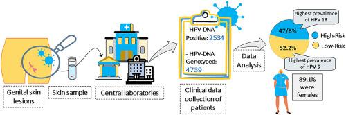 The prevalence of human papillomavirus genotypes among patients with sexually transmitted HPV in north Iran