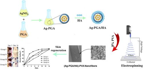 Nanomaterial strategies in wound healing: A comprehensive review of nanoparticles, nanofibres and nanosheets