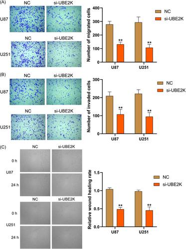 Silencing UBE2K inhibits the growth of glioma cells by inducing the autophagy-related apoptosis