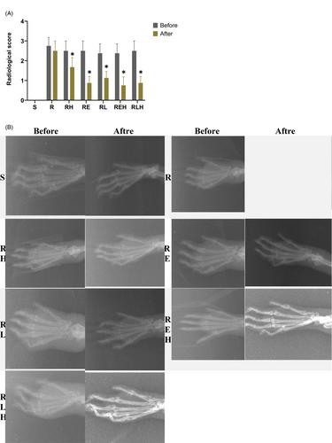 Comparison of disease-modifying anti-rheumatic drugs and hyperbaric oxygen therapy in the experimental model of rheumatoid arthritis in rats