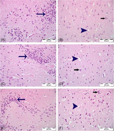 Investigation of the effects of curcumin and piperine on cyclophosphamide-induced brain injury in rats