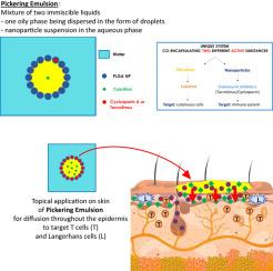 Coencapsulation of Immunosuppressive Drug with Anti-Inflammatory Molecule in Pickering Emulsions as an Innovative Therapeutic Approach for Inflammatory Dermatoses