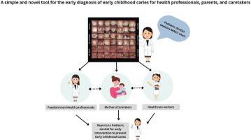 Early diagnosis of early childhood caries: A simple novel tool (MAAC charts) for parents and caretakers