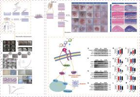 Development and optimization of the Glabridin-loaded dissolving microneedle for enhanced treatment of keloid