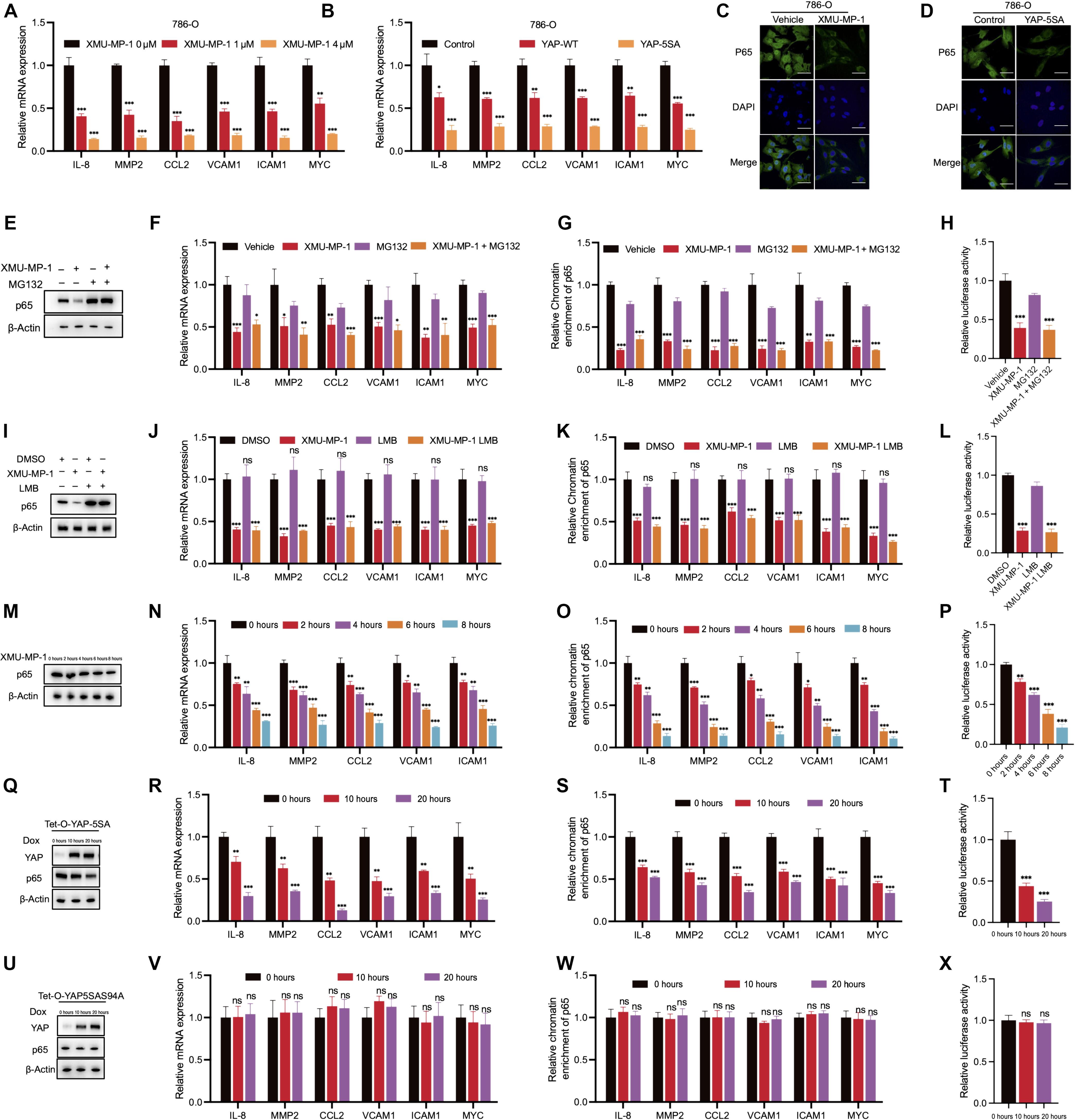 YAP represses the TEAD–NF-κB complex and inhibits the growth of clear cell renal cell carcinoma