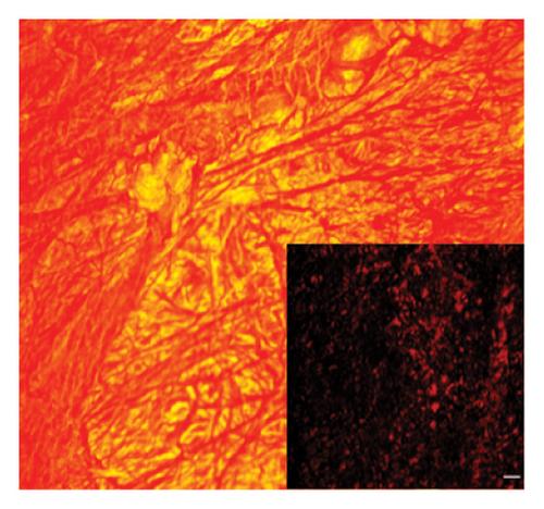 Decellularisation and Characterisation of Porcine Pleura as Bioscaffolds in Tissue Engineering