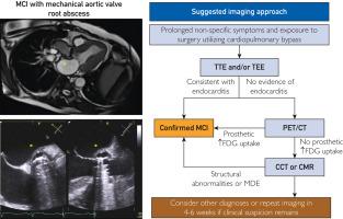 Multimodal Imaging in Mycobacterium Chimaera Cardiovascular Infections: The Mayo Clinic Experience