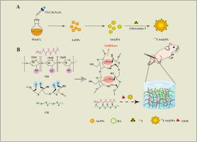 Radiosensitizer-based injectable hydrogel for enhanced radio-chemotherapy of TNBC