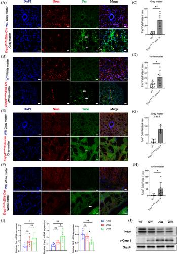 Development of a mouse model of chronic ventral spinal cord compression: Neurobehavioral, radiological, and pathological changes