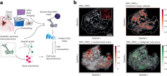 Optical microscopy and transcriptomics reveal the origins of fluorescence in glioma surgery