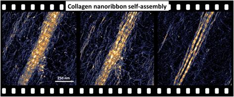 In Operando Imaging Electrostatic-Driven Disassembly and Reassembly of Collagen Nanostructures