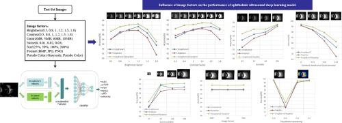 Influence of Image Factors on the Performance of Ophthalmic Ultrasound Deep Learning Model