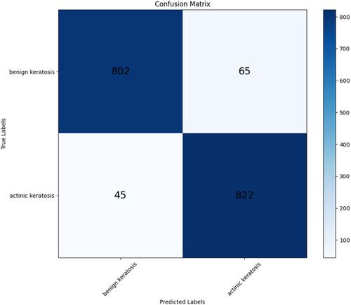 Enhancing Skin Disease Diagnosis Through Deep Learning: A Comprehensive Study on Dermoscopic Image Preprocessing and Classification