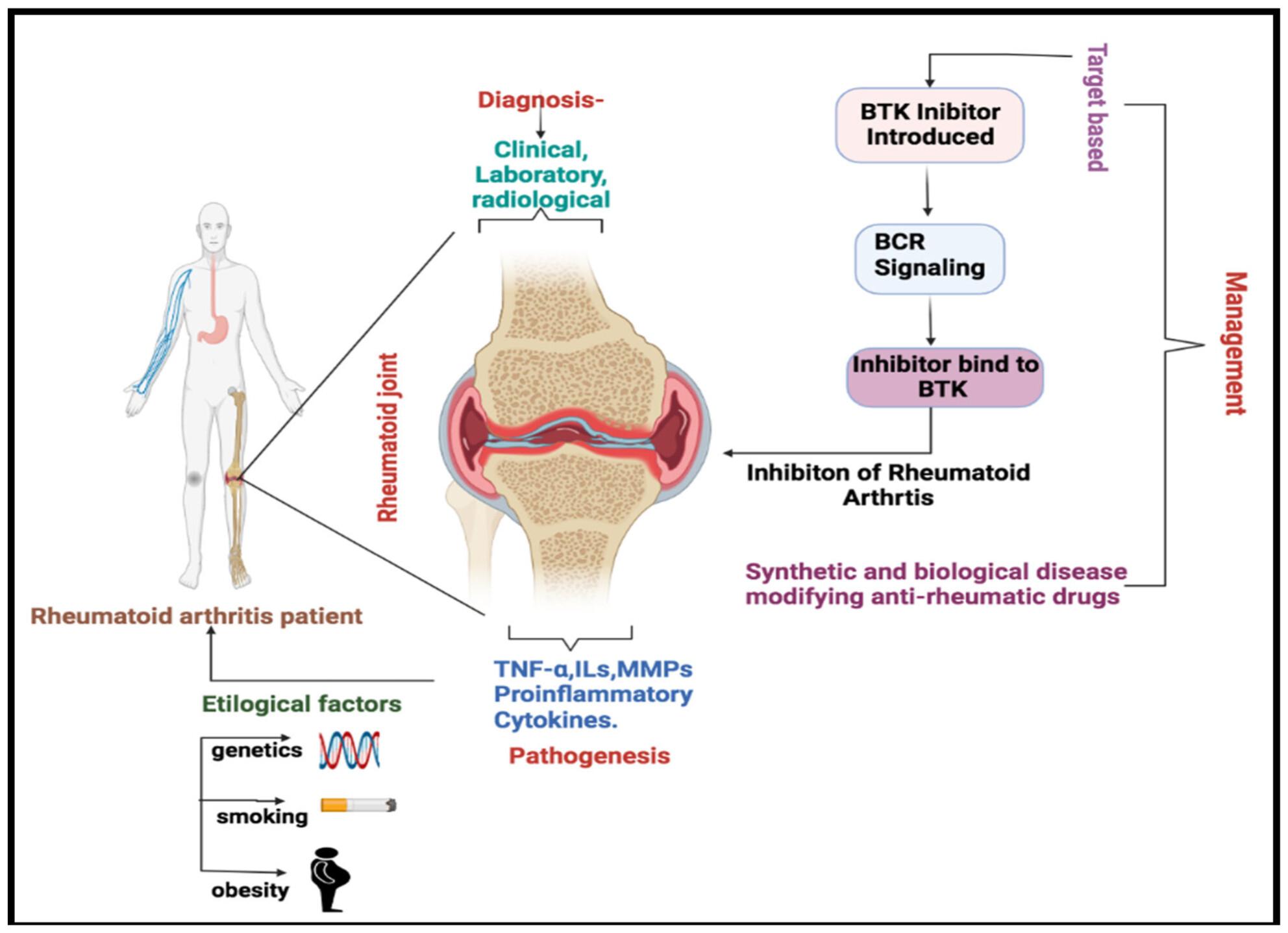 Therapeutic potential and recent progression of BTK inhibitors against rheumatoid arthritis