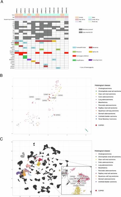 Metastatic renal cell carcinoma with occult primary: a multicenter prospective cohort