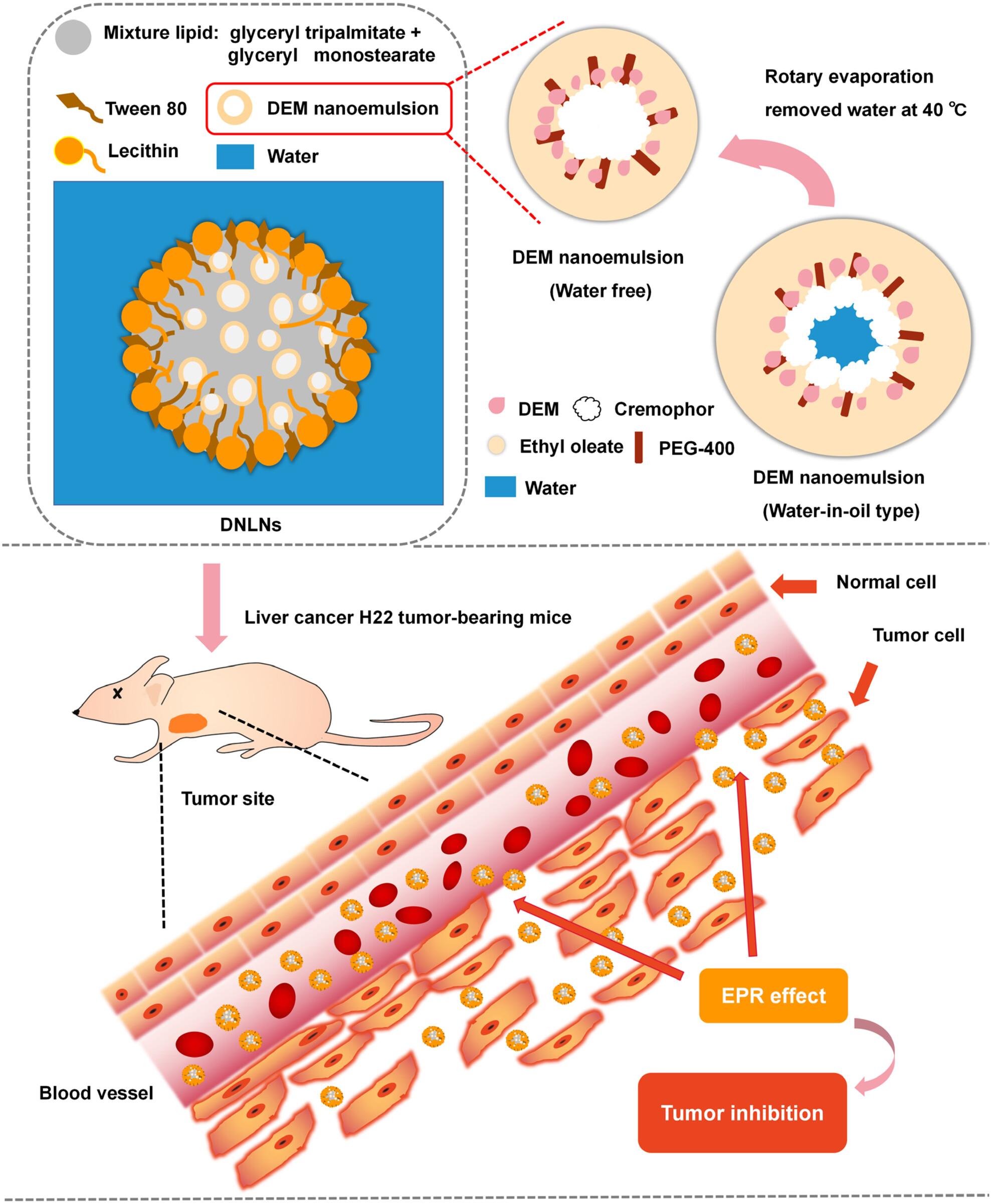 Nanoemulsion based lipid nanoparticles for effective demethylcantharidin delivery to cure liver cancer