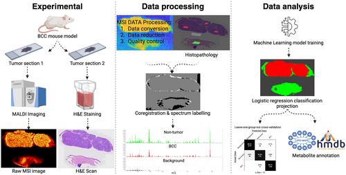 Metabolomic profiling and accurate diagnosis of basal cell carcinoma by MALDI imaging and machine learning